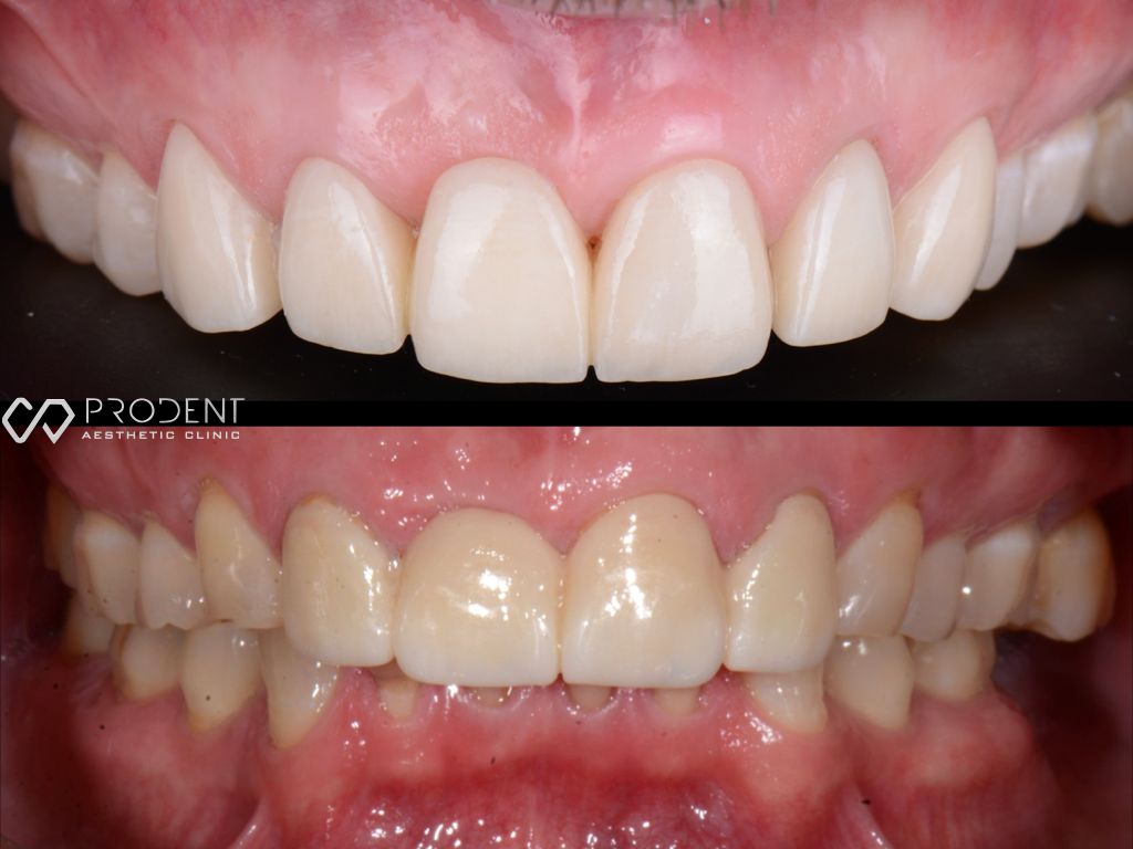 Ulises Pérez Murillo-92