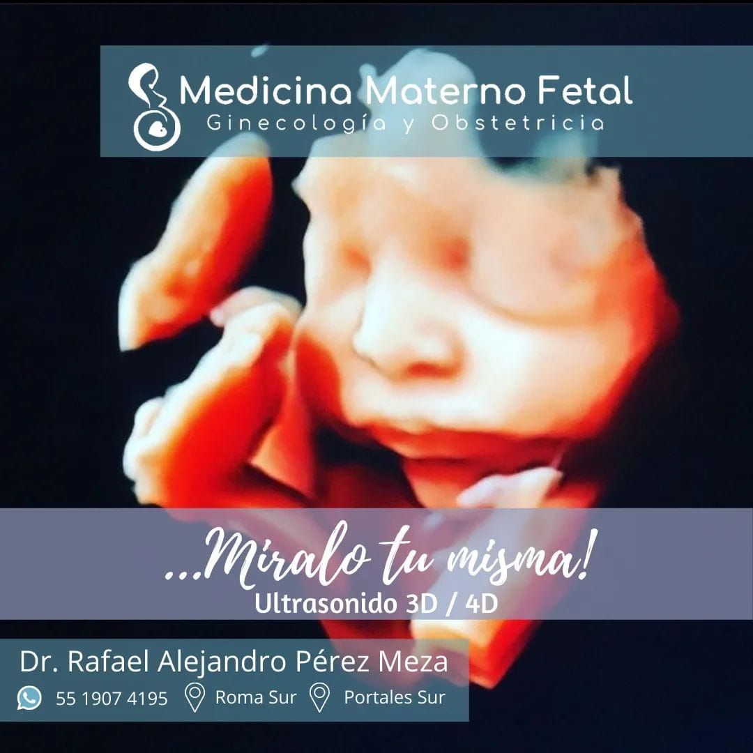 Rafael Alejandro Pérez Meza-6