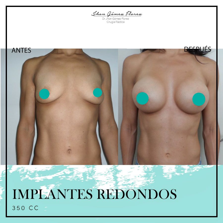 Jhon César Gómez Florez-43