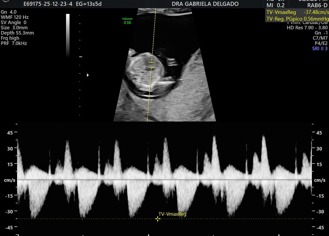 Gabriela Delgado Serrano-5