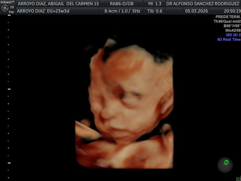 Alfonso Sanchez Rodriguez-52