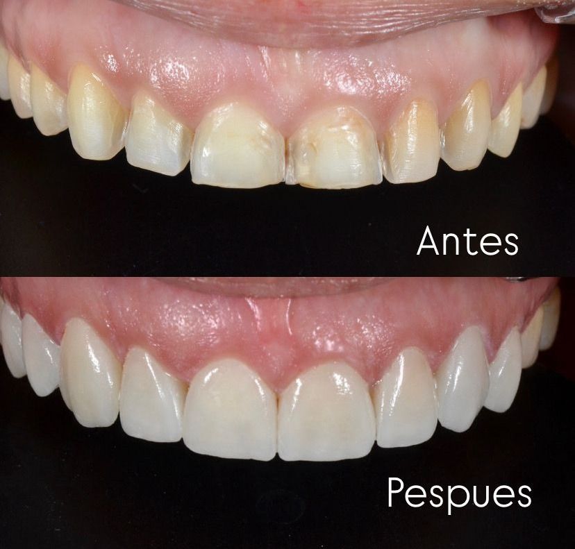 Francisco Jose Vives Serrano-36