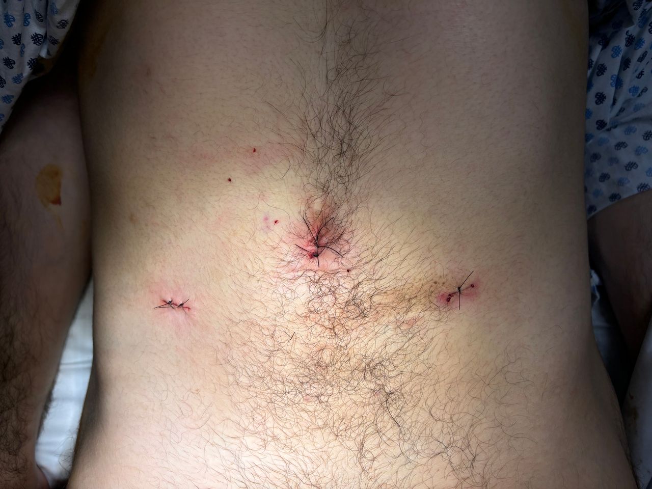 Edgar Raziel Acosta May-10