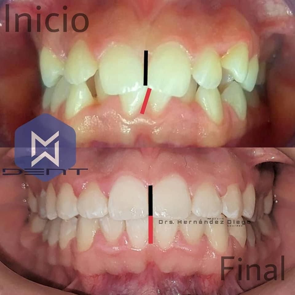 Marvin Adair Hernández Álvarez-48