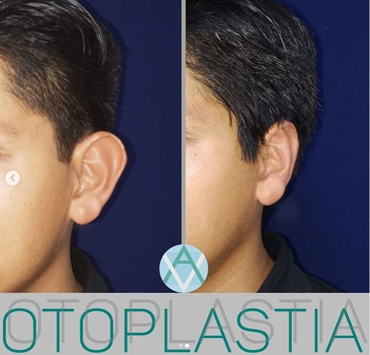 Alfonso Villaseñor Herrero-18