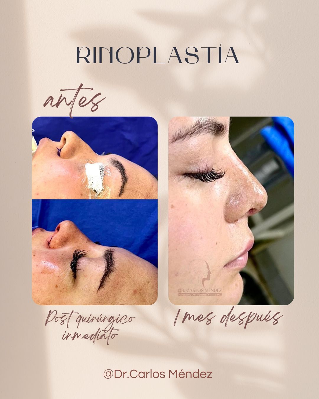 Juan Carlos Mendez Gutierrez-13