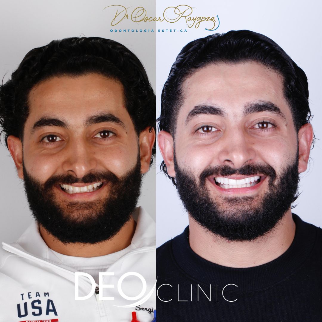 Oscar Raygoza Carrillo-66