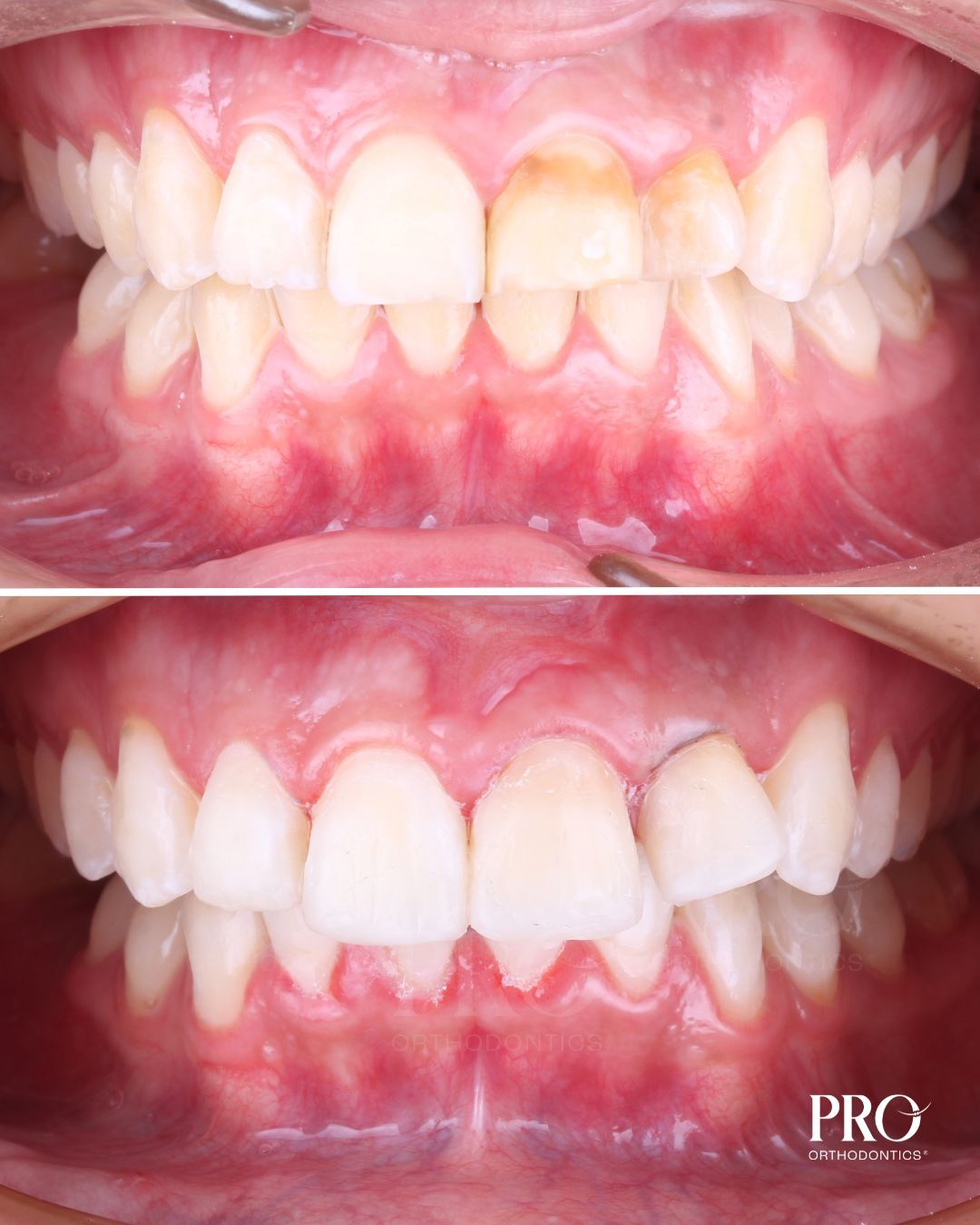 Verail Ruacho-5