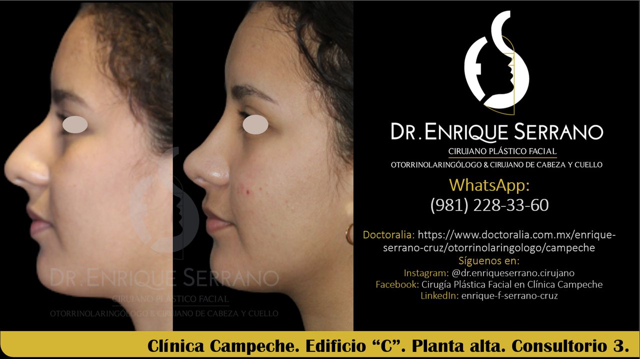 Enrique Serrano Cruz-71