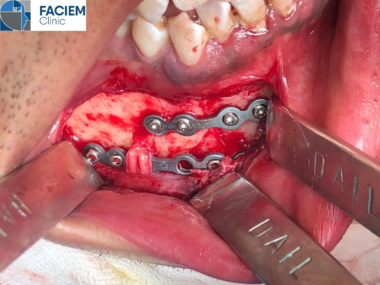 Arlen Colín Ordaz-23