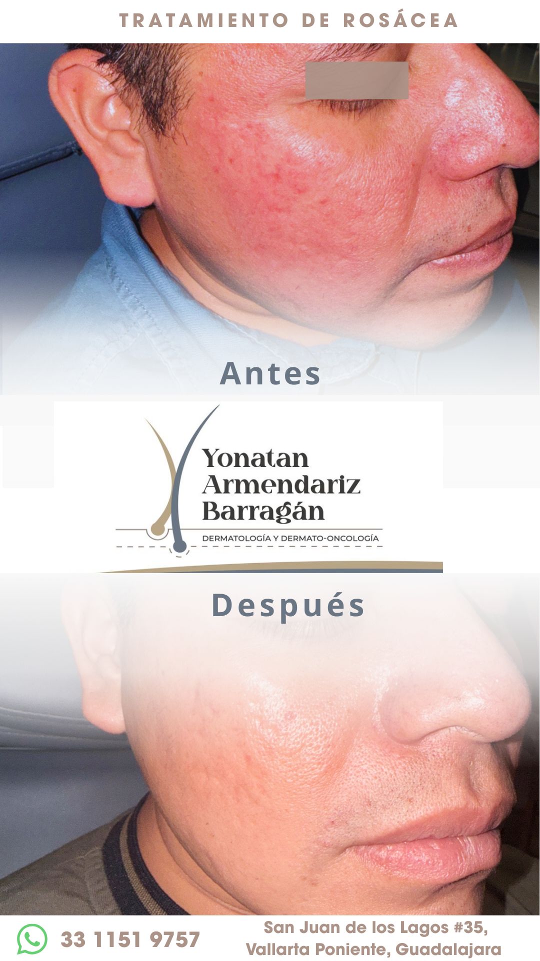 Yonatan Armendariz Barragán-0