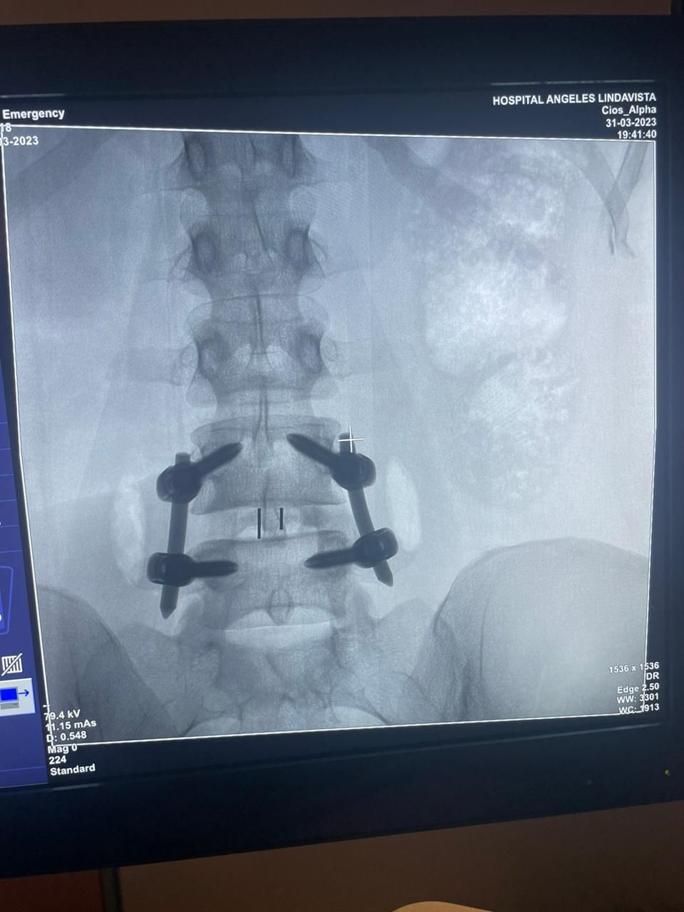 Gerson Reyes Rodríguez-33