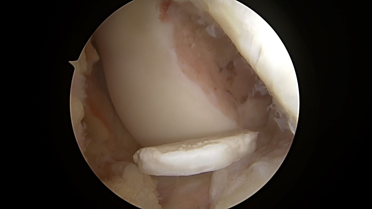 José Antonio Algarín Reyes-45