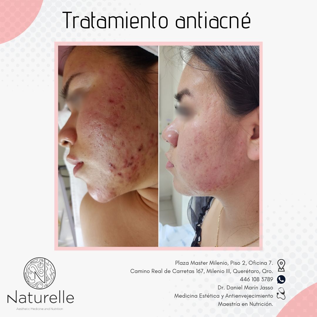 Daniel Marín Jasso-17