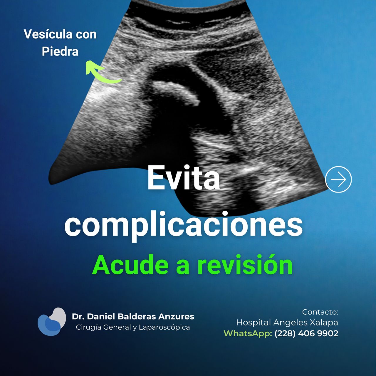 Daniel Balderas Anzures-11