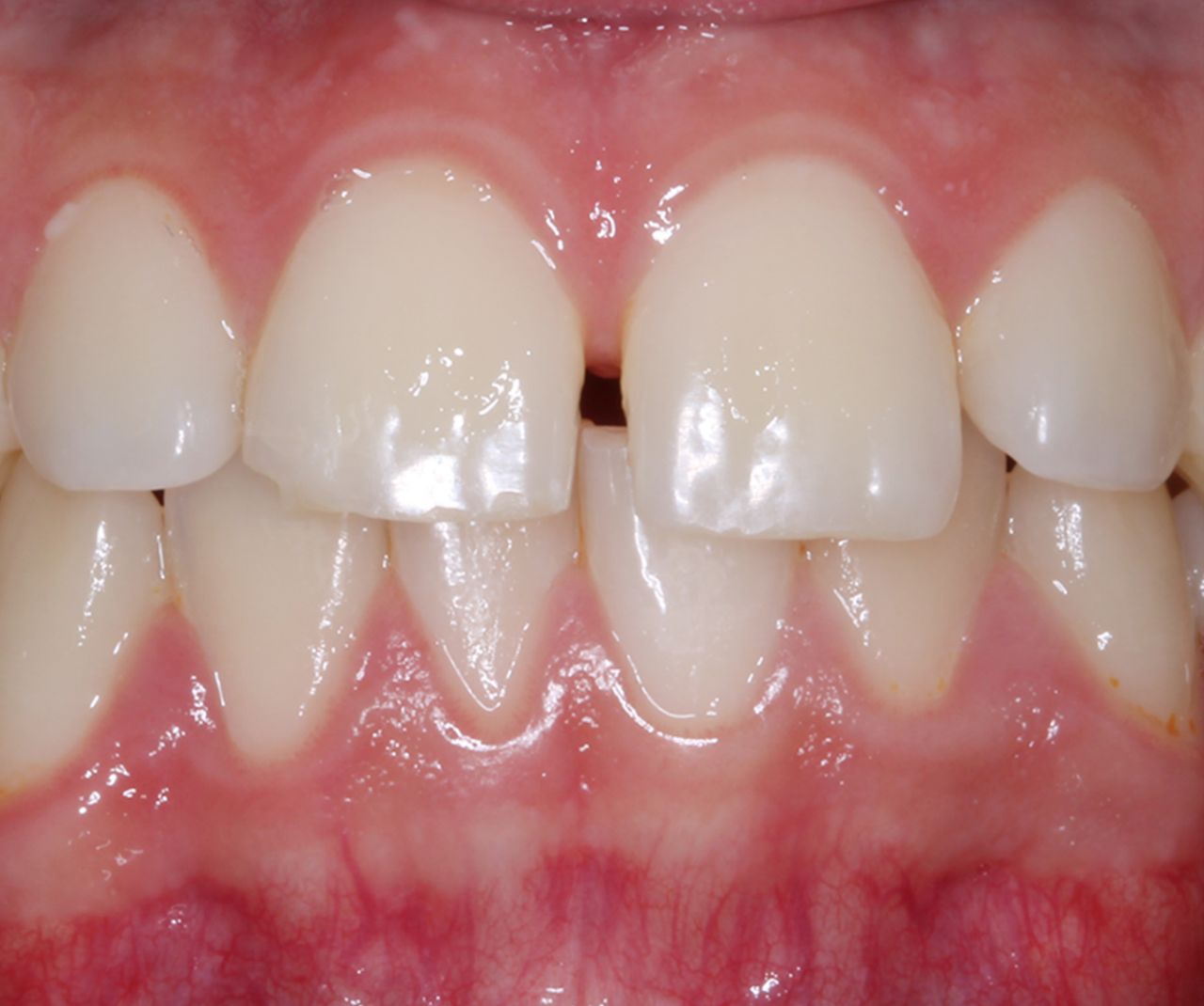 Erika Monserrat Quiroz Martínez-12