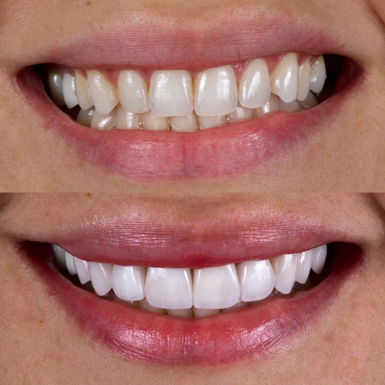 Mauricio Villegas Akena-15