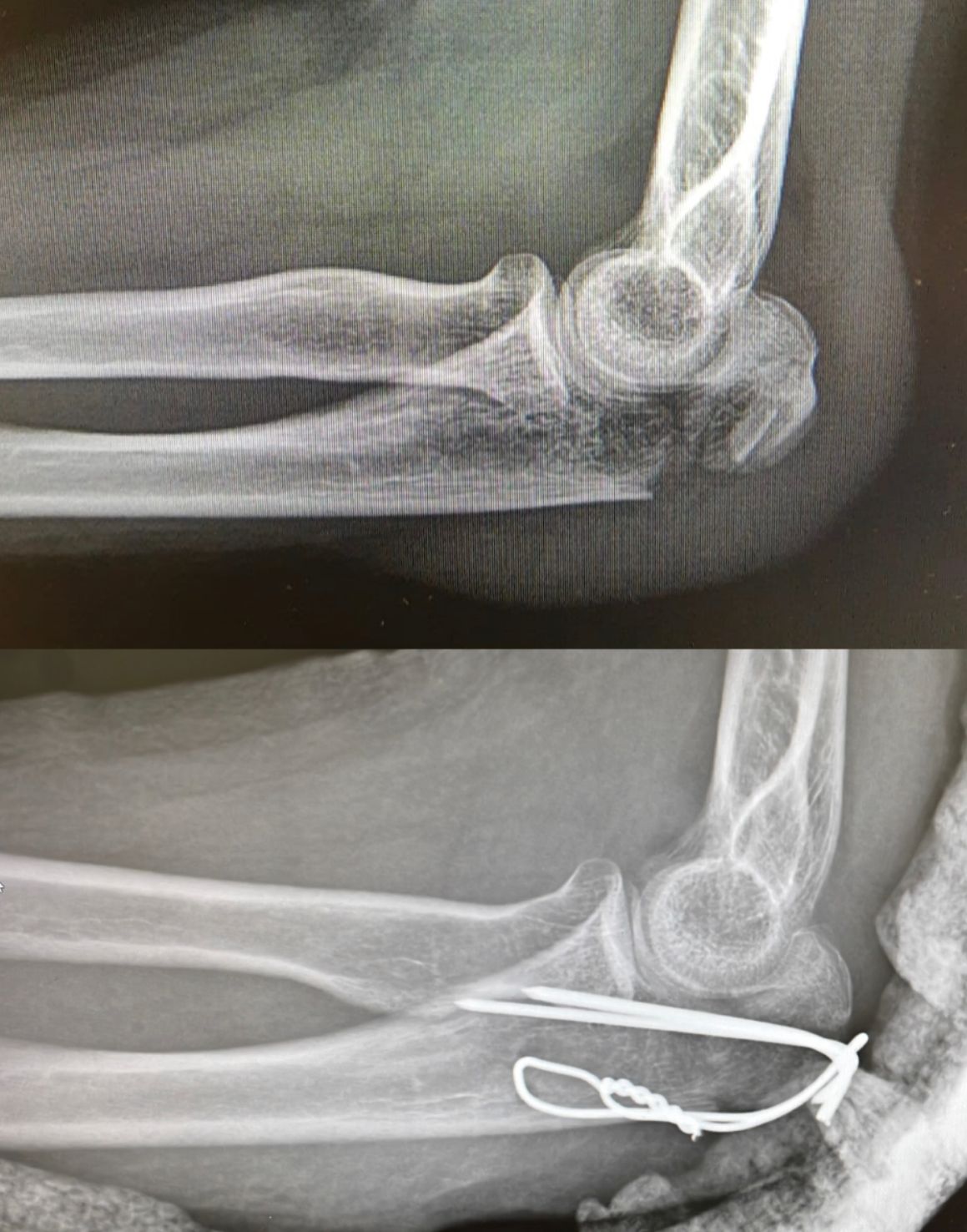 Diego Armando Contreras Rojas-12