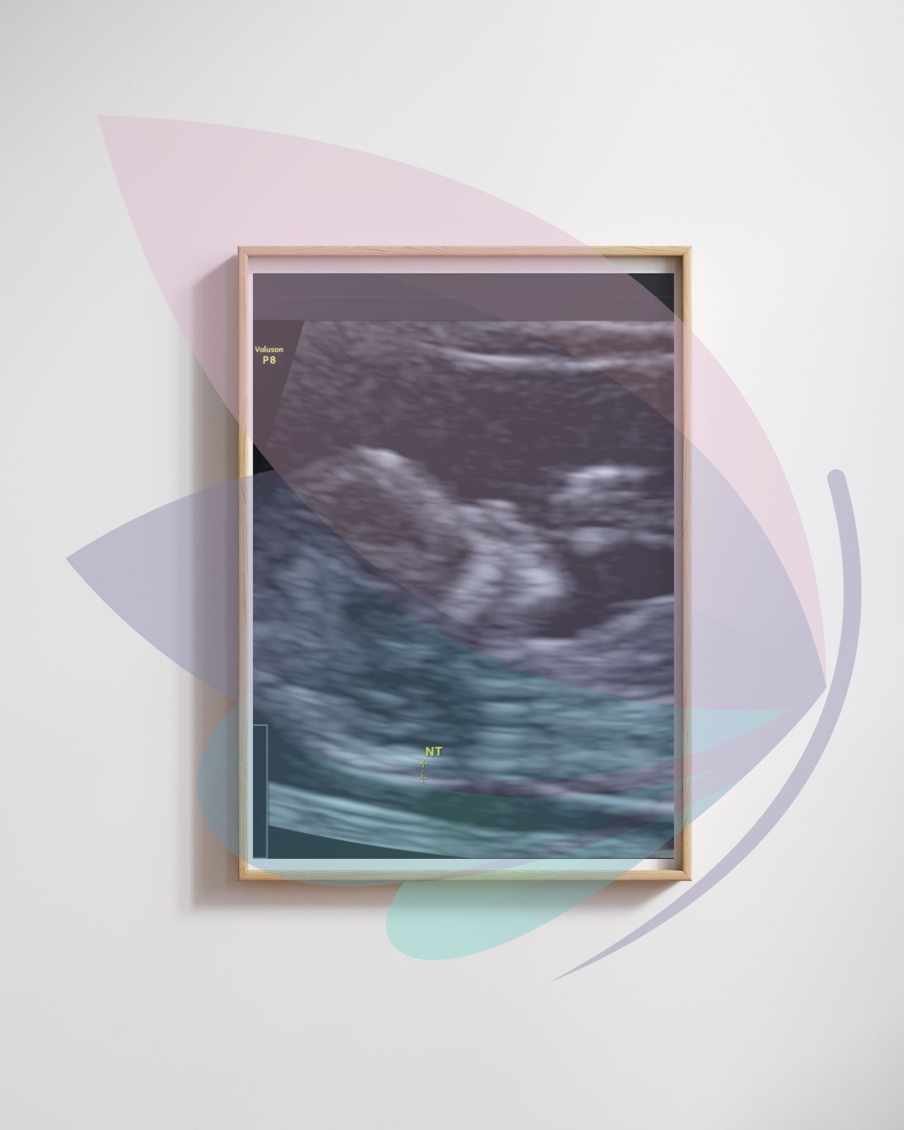 Edgar Zárate Xochimatzi-11