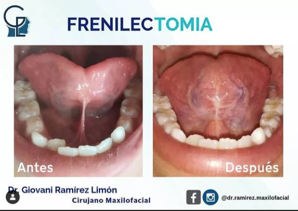 Giovani Ramírez Limón-40