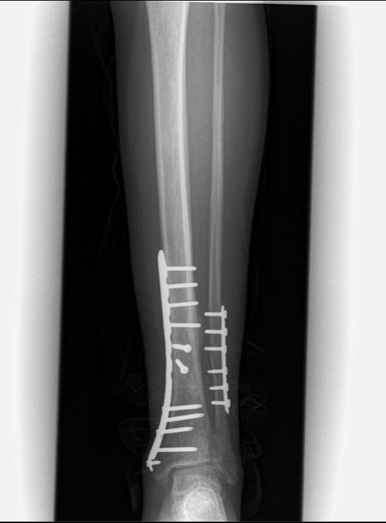 Salvador Medina Garnica-4