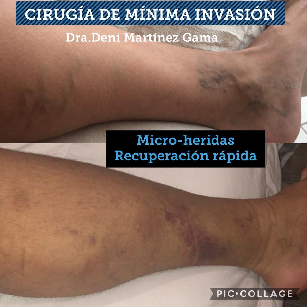 Deni Martínez Gama-14