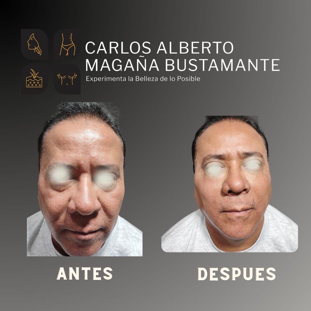 Carlos Alberto Magaña Bustamante-2