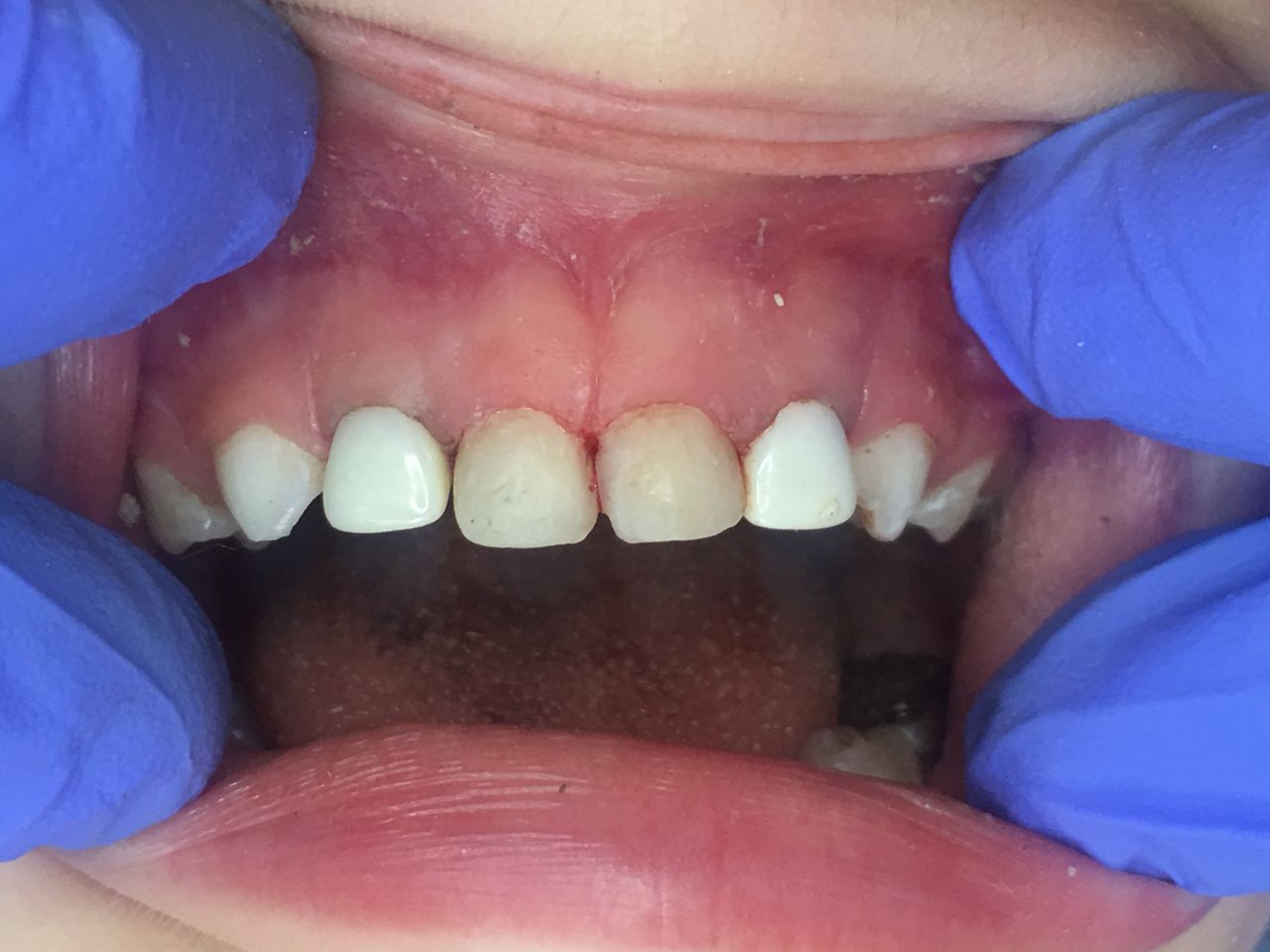 Patricia Rizo Palos-12