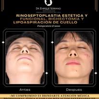 Enrique Serrano Cruz-18