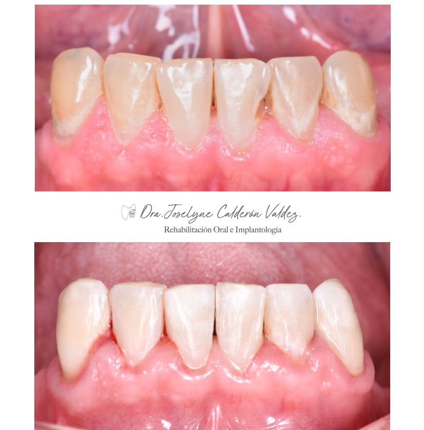 Joselyne Calderón Valdez-3