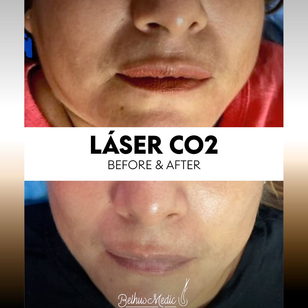 Alejandra Soriano Elorza-132