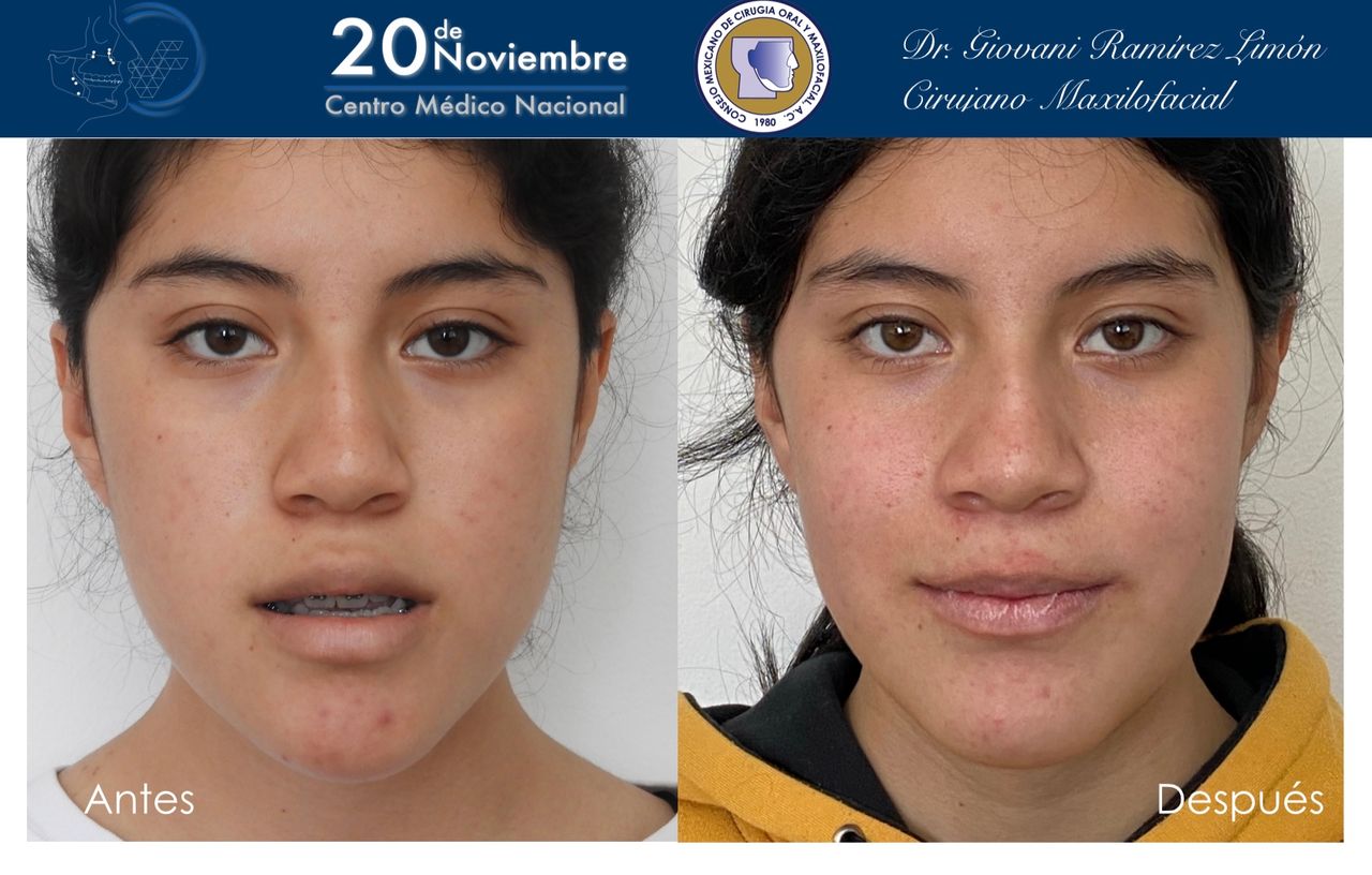 Giovani Ramírez Limón-26