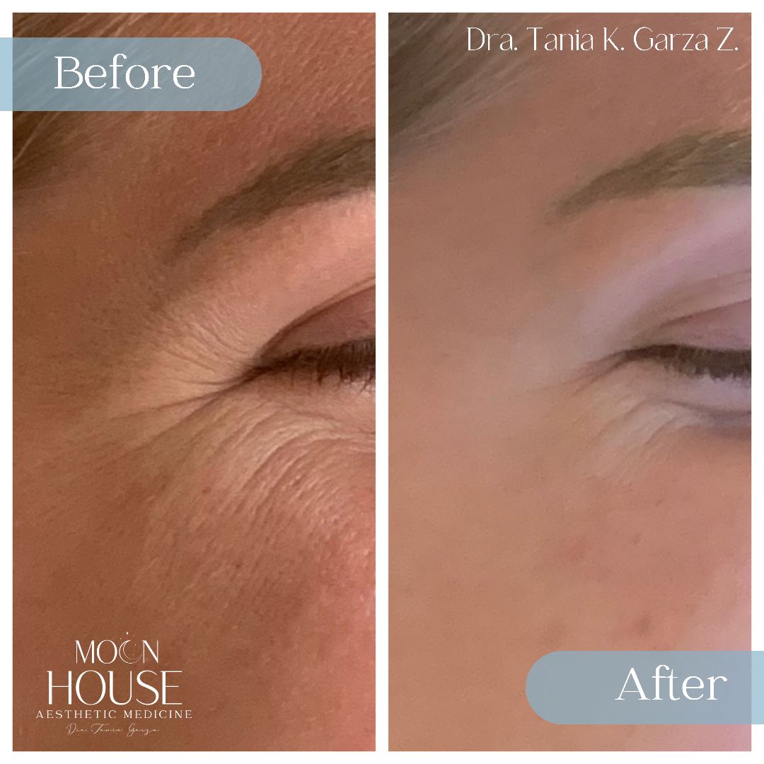 Tania Karine Garza Zepeda-13