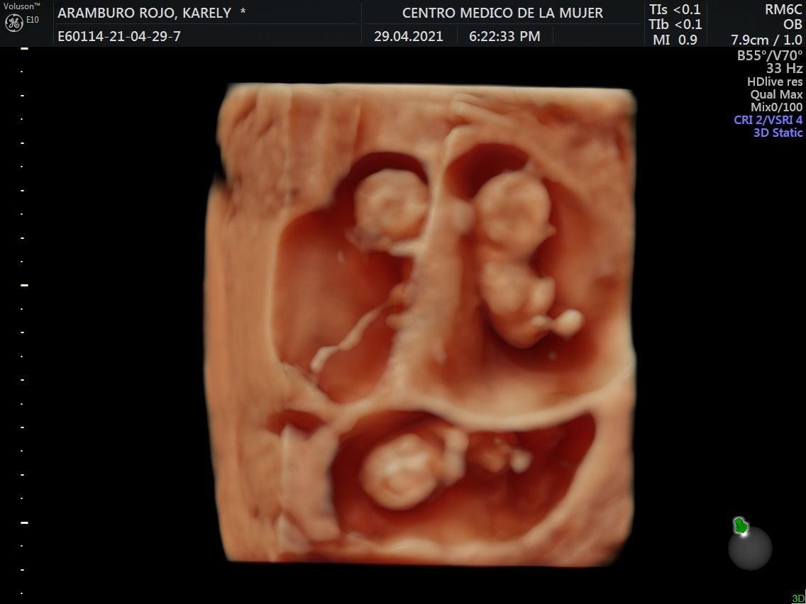 Julio Cesar Monárrez Martín-31