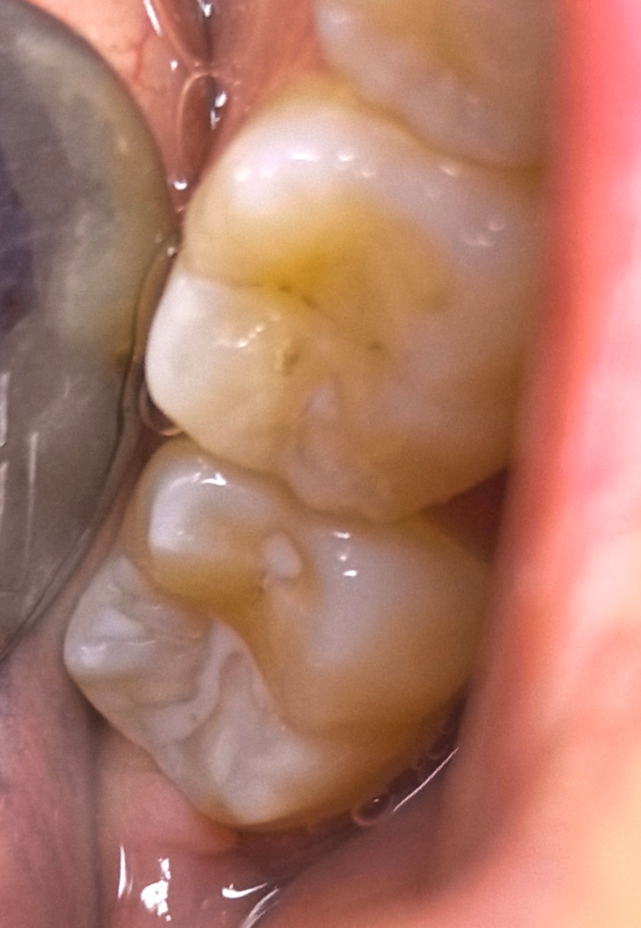 Ilse Nair Anaya Gutiérrez-3