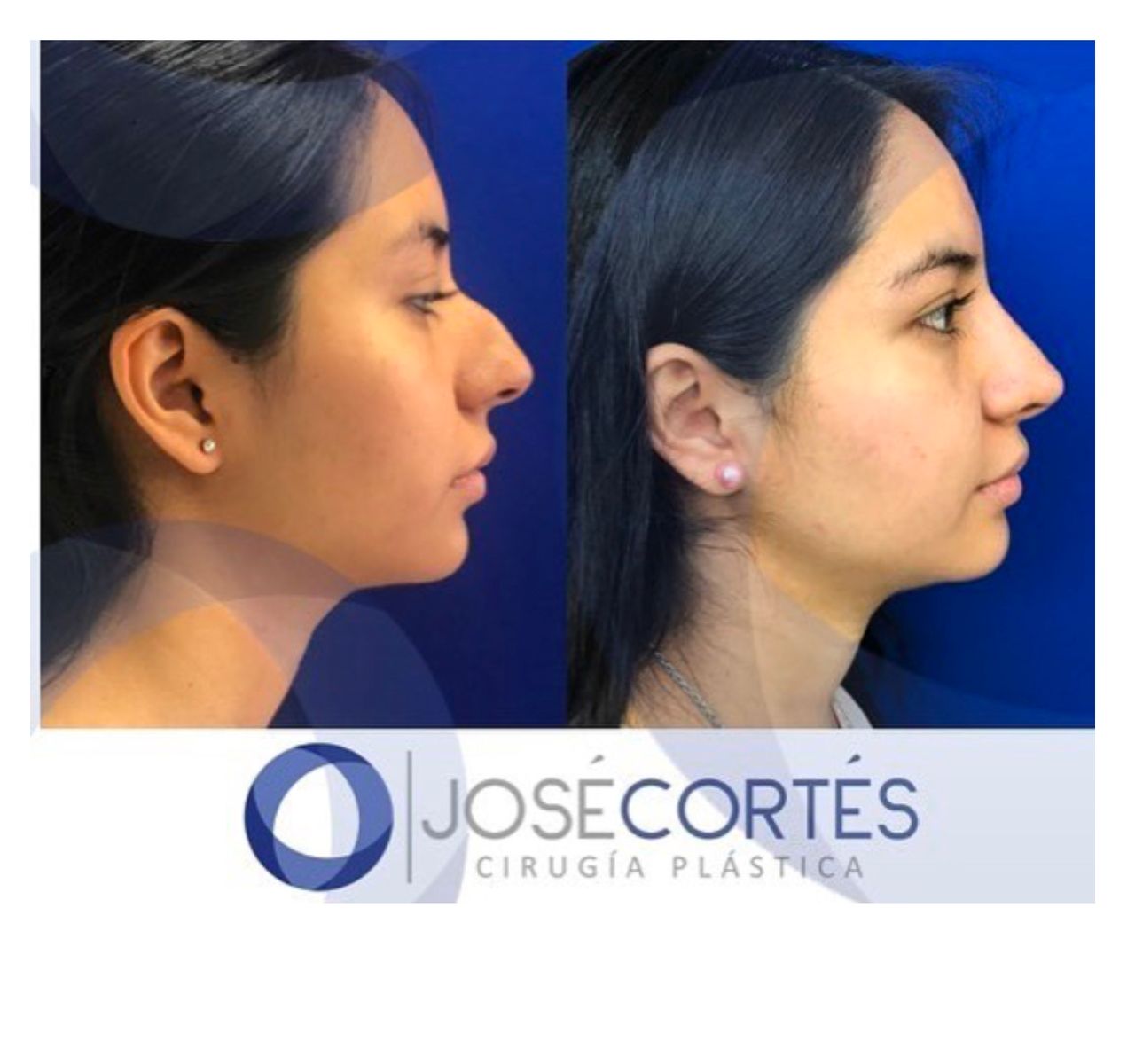 José Cortés Arreguin-11