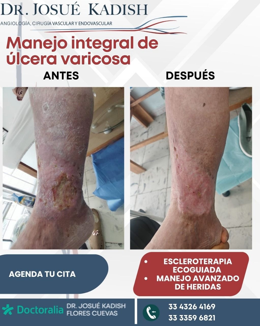 Josue Kadish Flores Cuevas-7