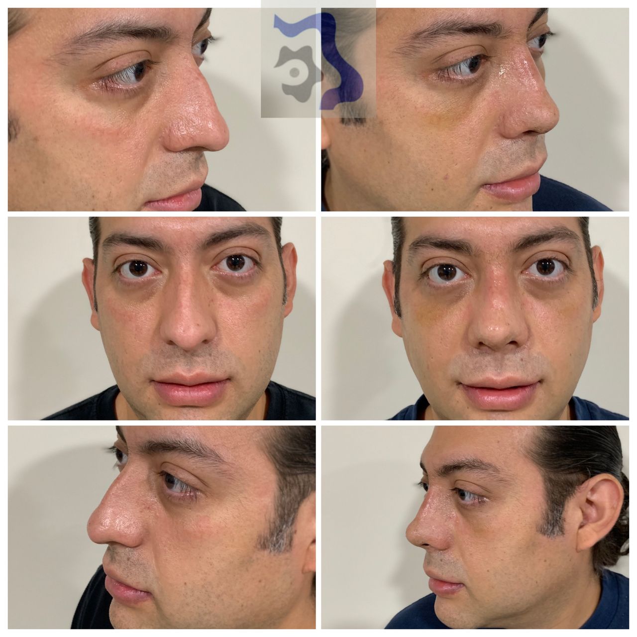 Cesar Alfonso Gutierrez Espinosa-6