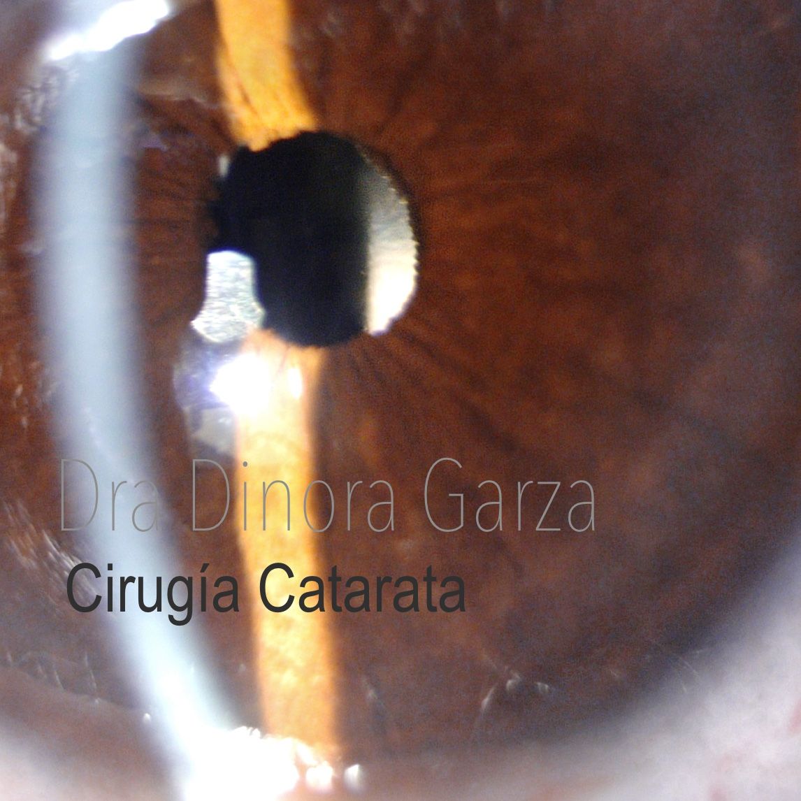 Dinora Garza Leal-20