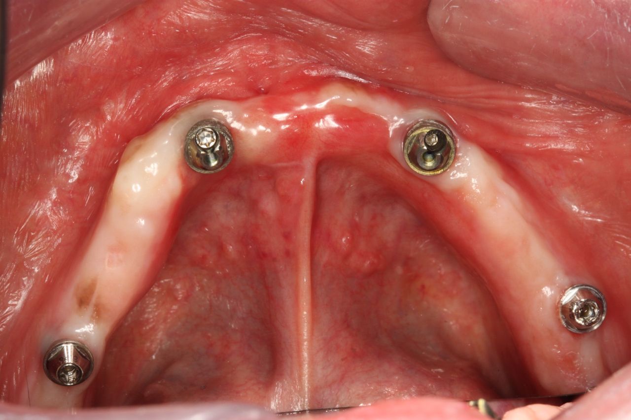 Sergio Cortes Peral-0