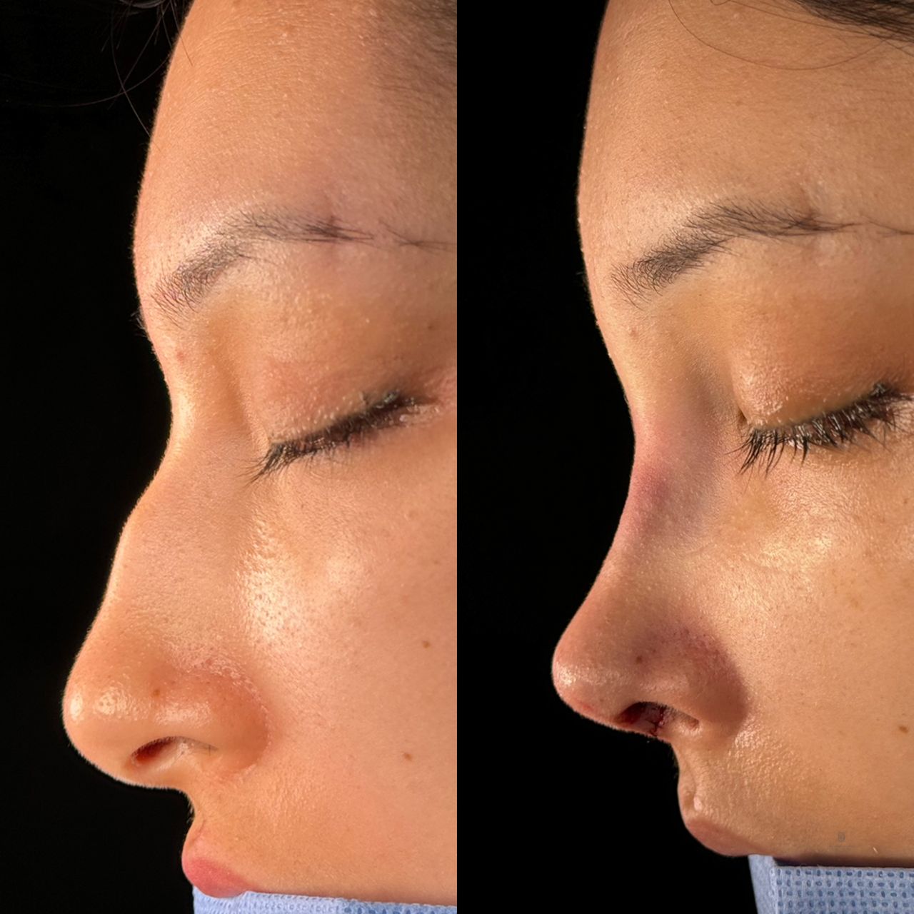 Angel Castro Urquizo-54