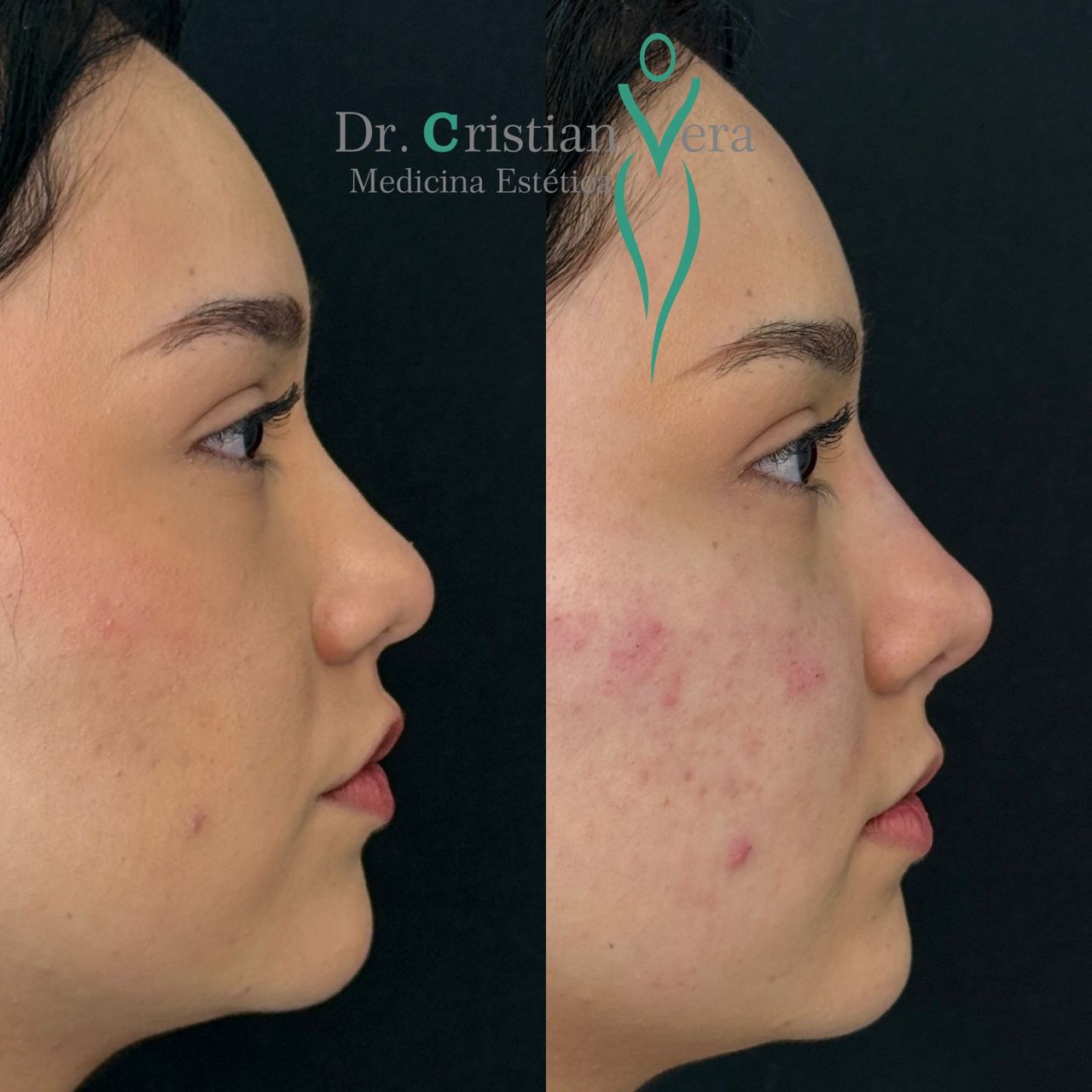 Cristian Eduardo Vera Nuño-20