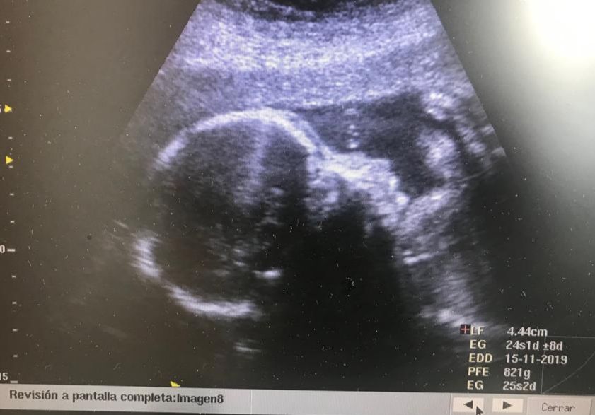 Germán Gabriel Palacios López-31