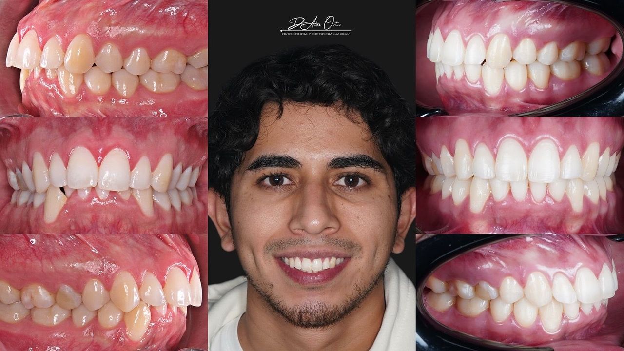 Alan Edgardo Ortiz Arenas-2