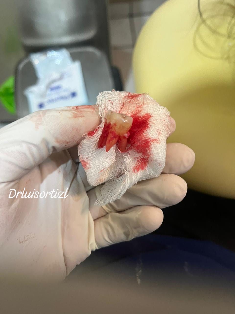 Luis Ángel Ortiz López-26