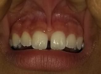 Zeyda Oliman Hoyos-6