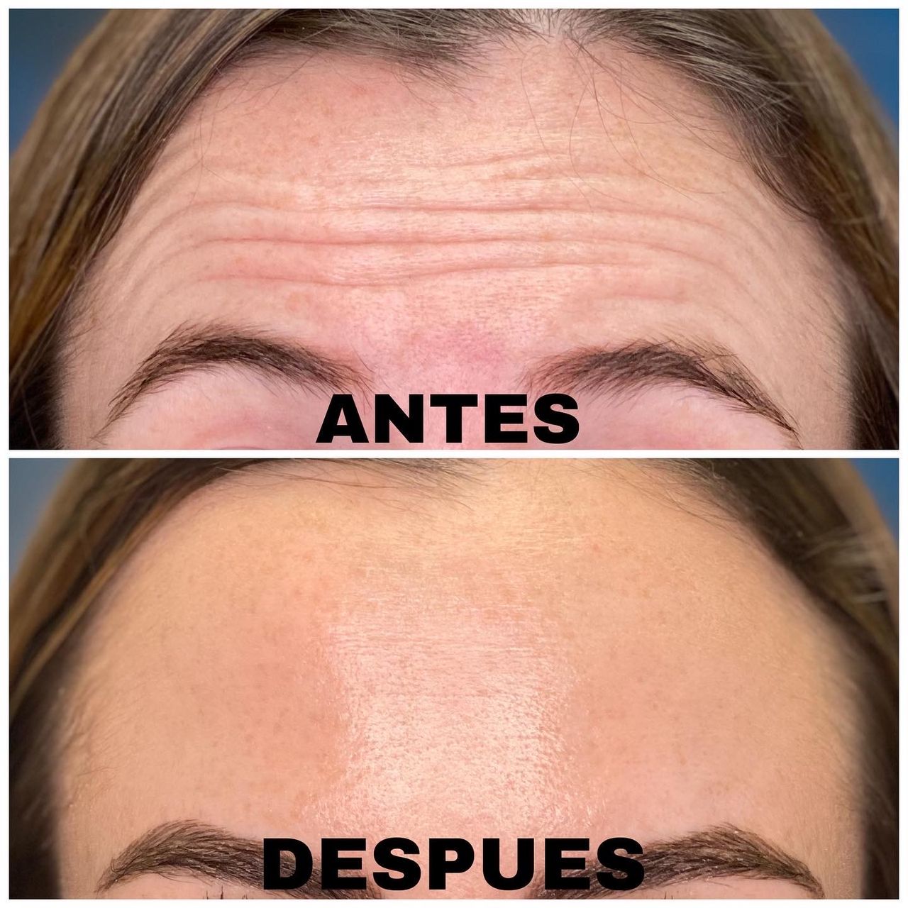 Carlos Alberto Ruiz Zepeda-20