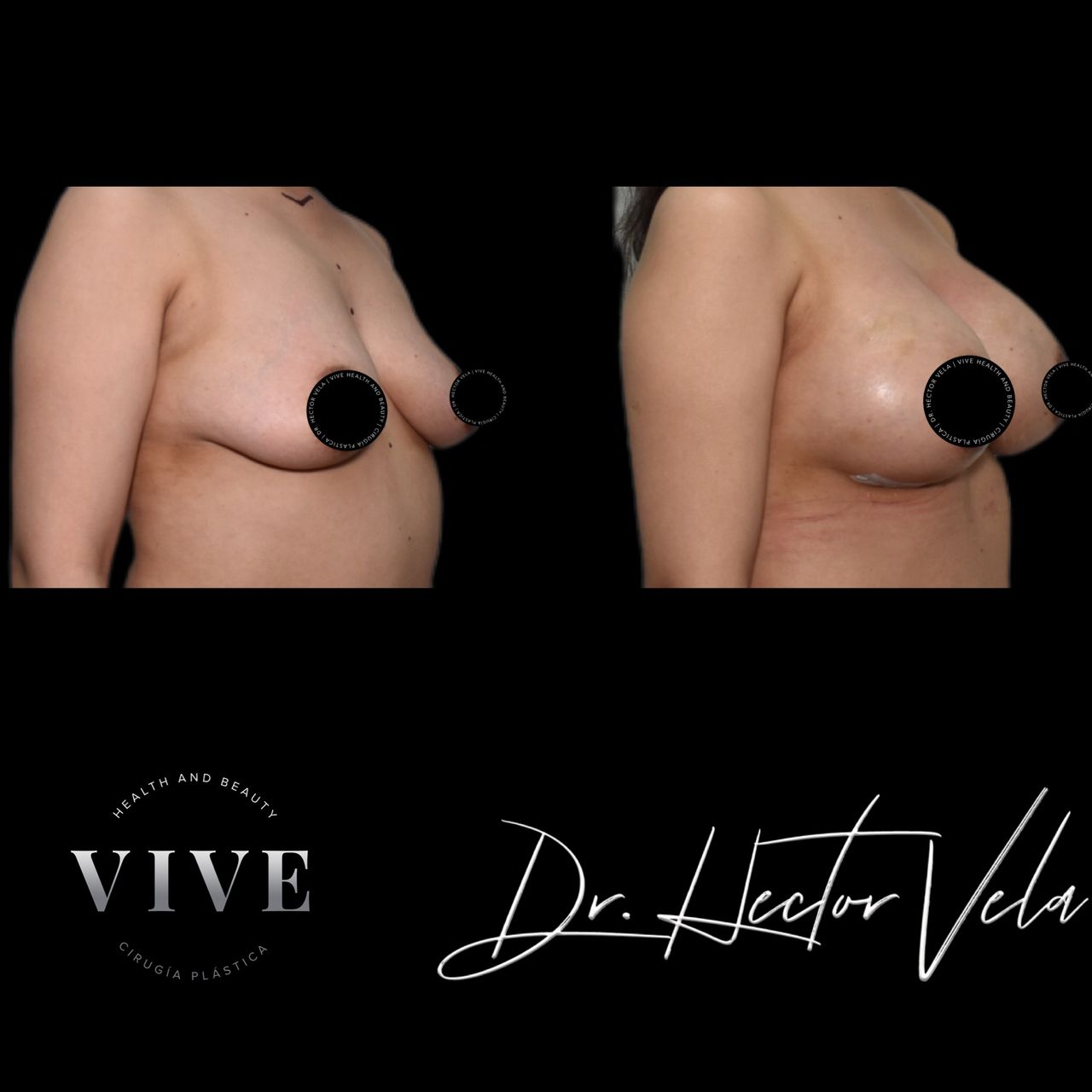 Héctor Eduardo Vela Cardona-220