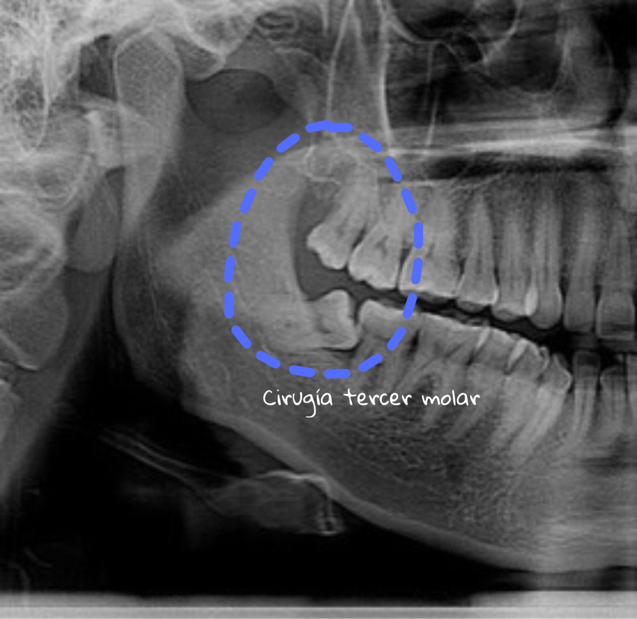 Evelin Karolina Carrillo Solís-3