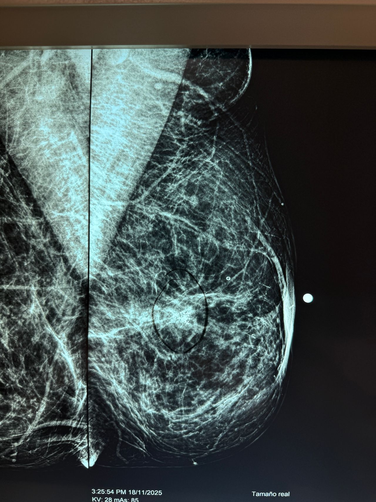 Christian Samuel Uitzil Colli-1